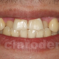 Ortodontie 10