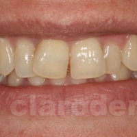 Ortodontie 2