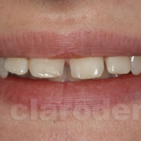 Ortodontie 3