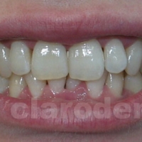 Ortodontie 5