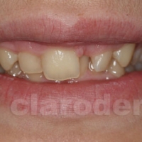 Ortodontie 7