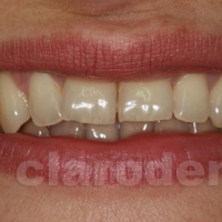 Ortodontie 8