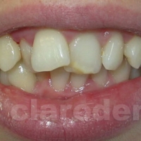Ortodontie 9