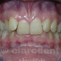 Ortodontie 1