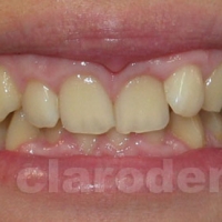Ortodontie 4