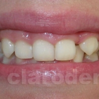 Ortodontie 6