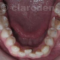 Protetica 4