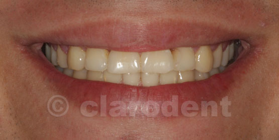 Ortodontie Caz 10
