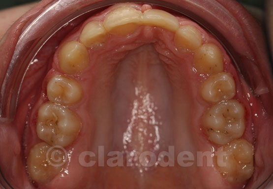 Ortodontie Caz 7