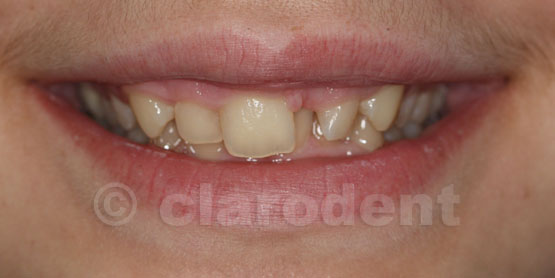 Ortodontie Caz 7