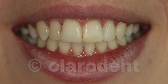 Ortodontie Caz 9