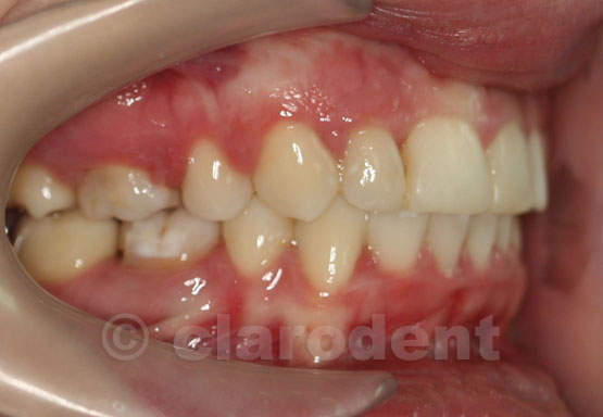 Ortodontie Caz 9
